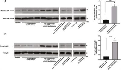 Antiphospholipid antibodies in patients with stroke during COVID-19: A role in the signaling pathway leading to platelet activation